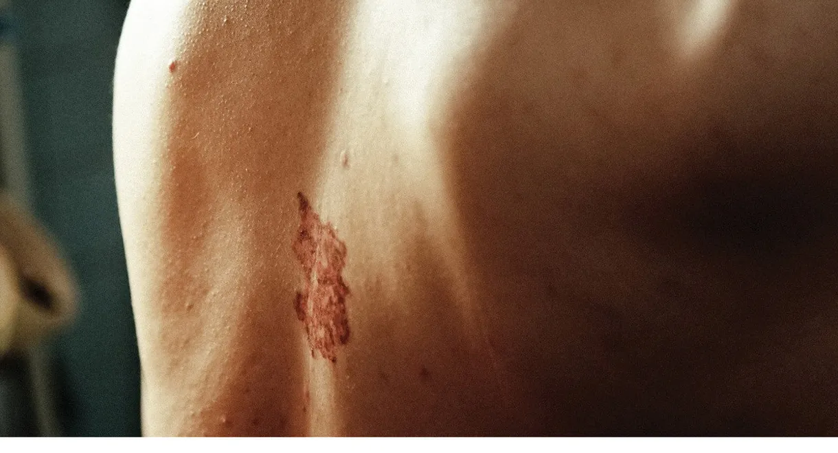 Original Wound