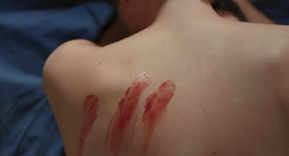 Wound