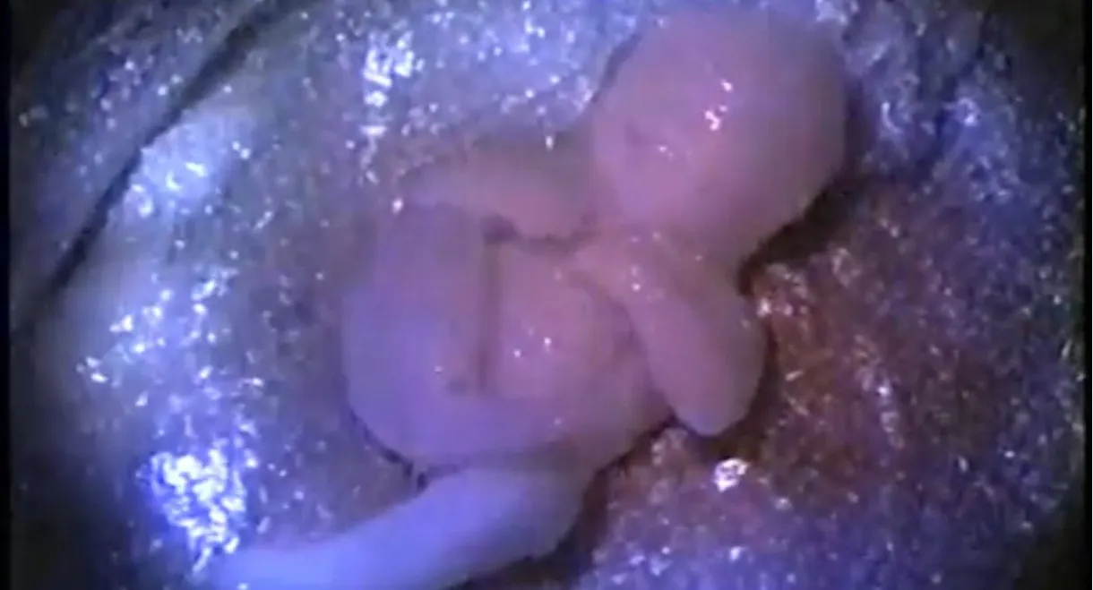 Busted Babies