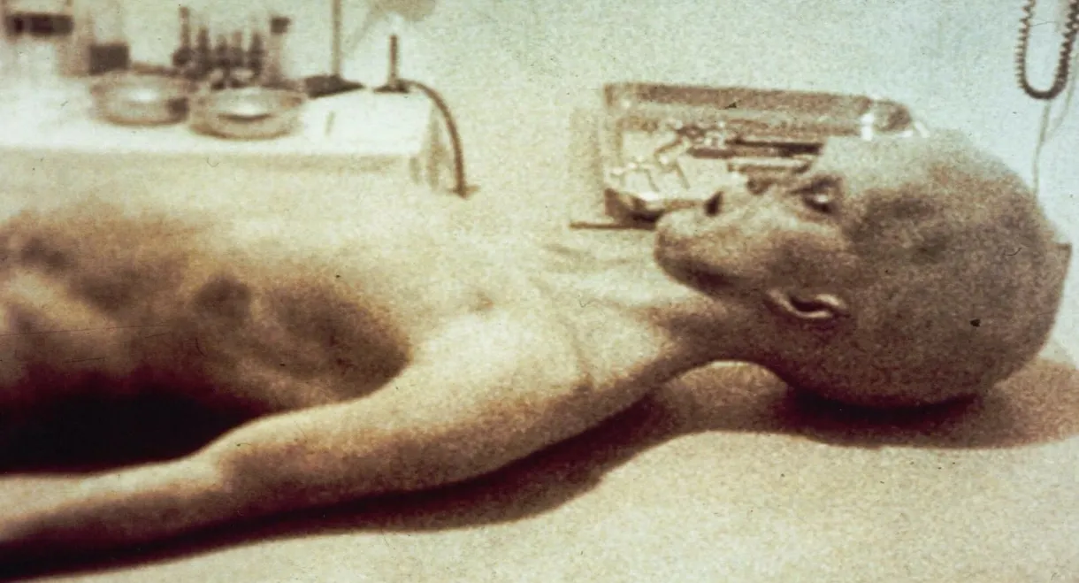 The Alien Autopsy