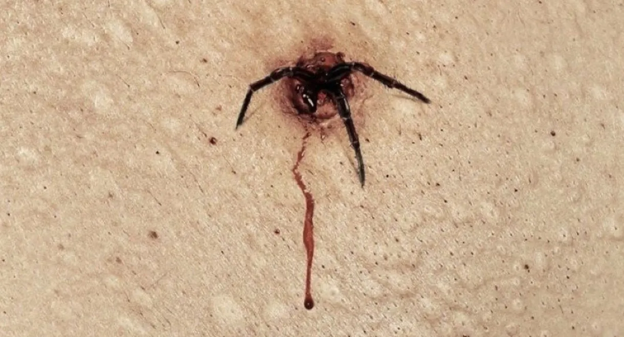 The Plague