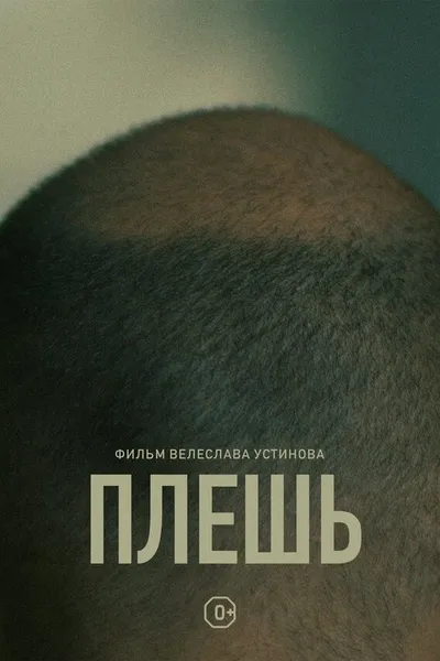 Baldness