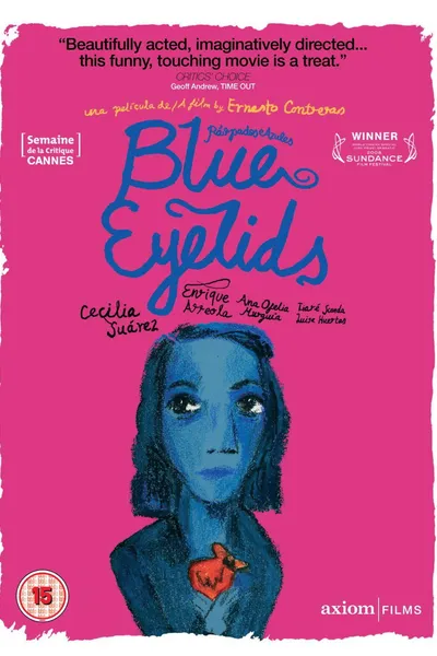 Blue Eyelids