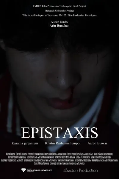 EPISTAXIS