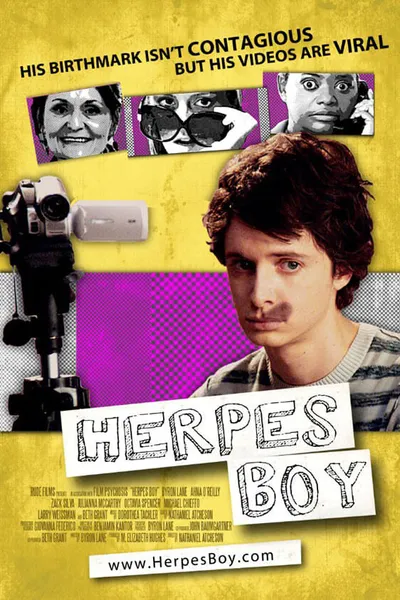 Herpes Boy