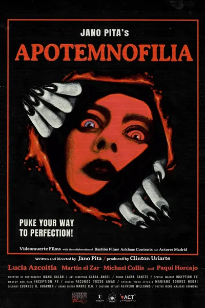 Apotemnofilia