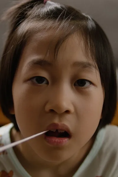 Milk tooth