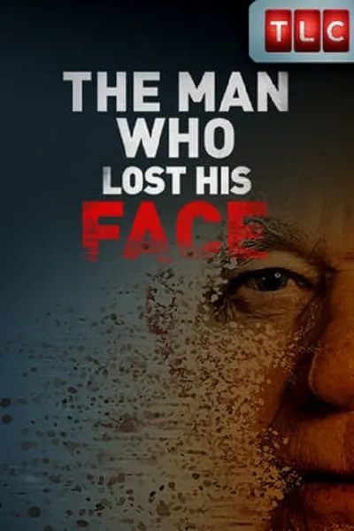 The Man Who Lost His Face