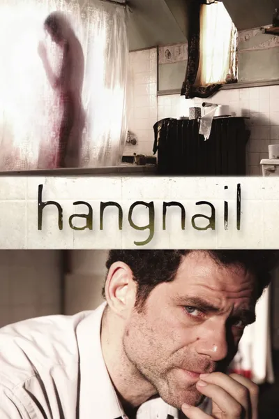 Hangnail