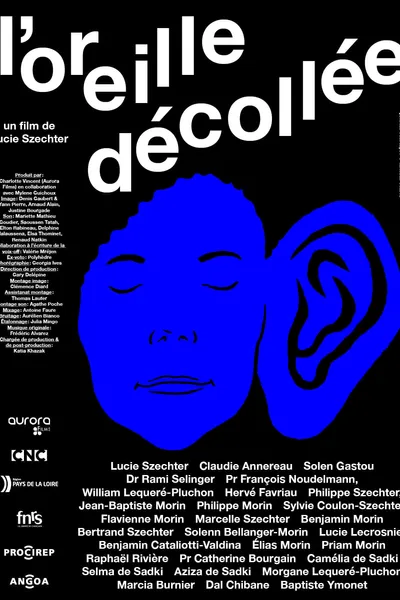 L'oreille décollée