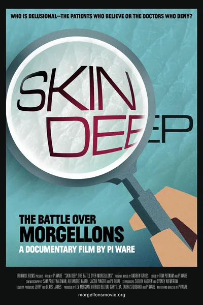 Skin Deep: The Battle Over Morgellons