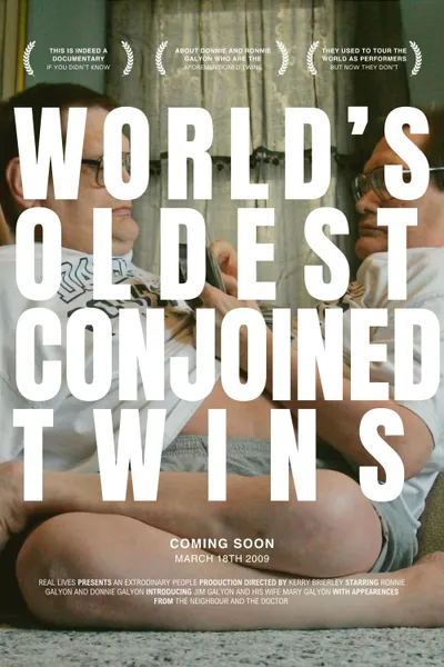 The World's Oldest Conjoined Twins