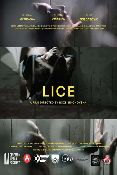 Lice