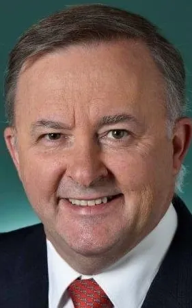 Anthony Albanese