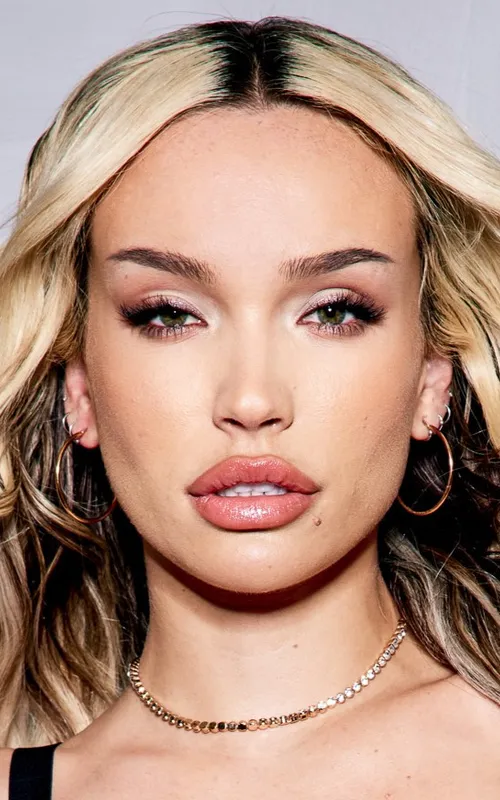Rara Knupps