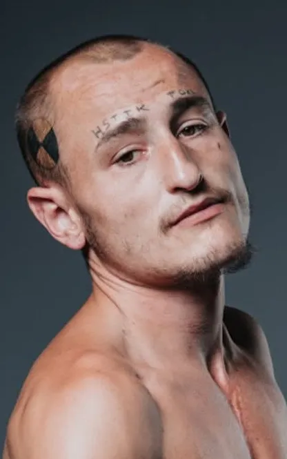 Callum Chester