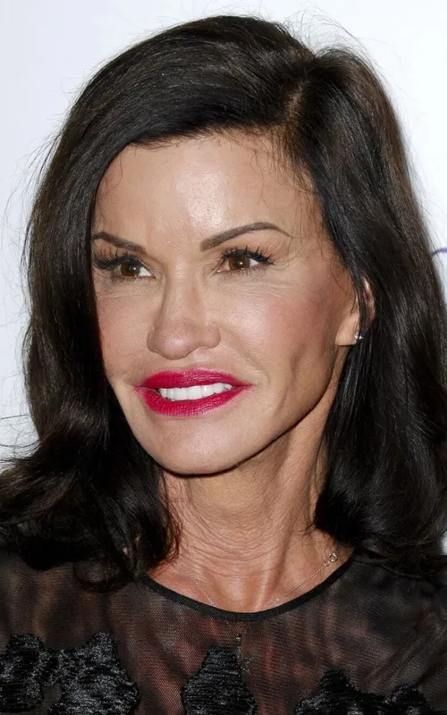 Janice Dickinson