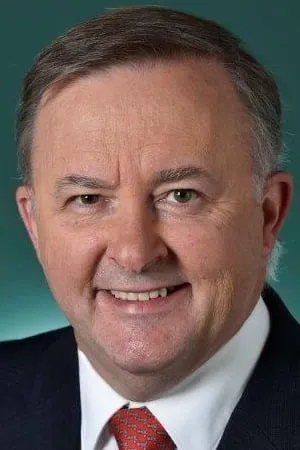 Anthony Albanese