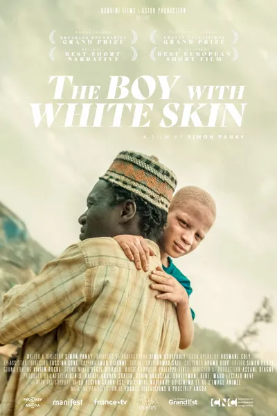 The Boy with White Skin