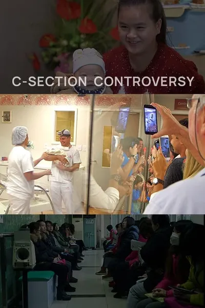 The C-Section Controversy