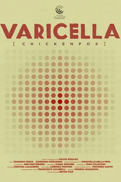 Varicella