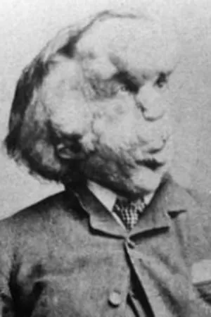 Joseph Merrick