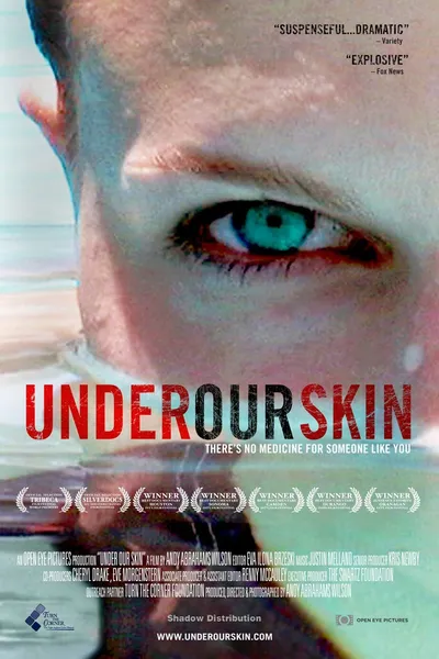 Under Our Skin