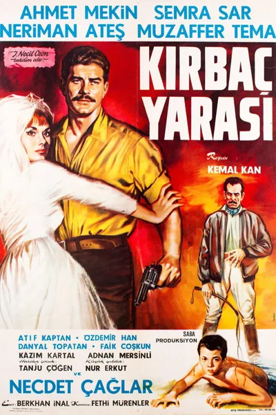 Kırbaç Yarası