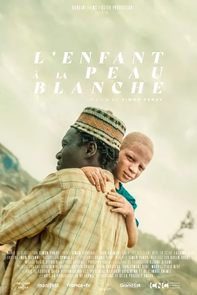 L'Enfant à la Peau Blanche