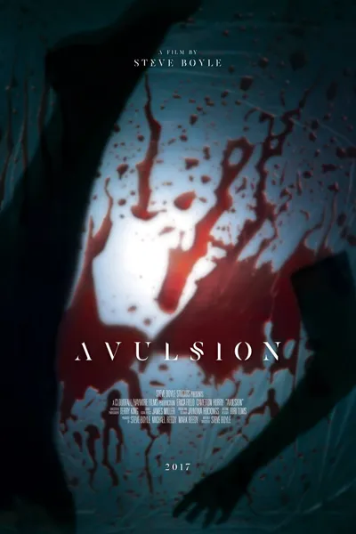 Avulsion