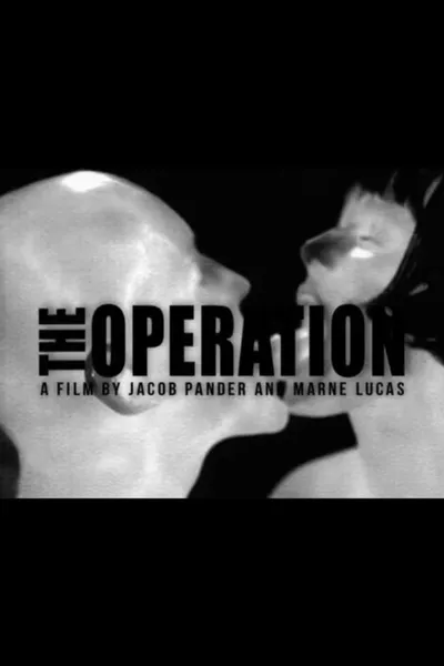 The Operation