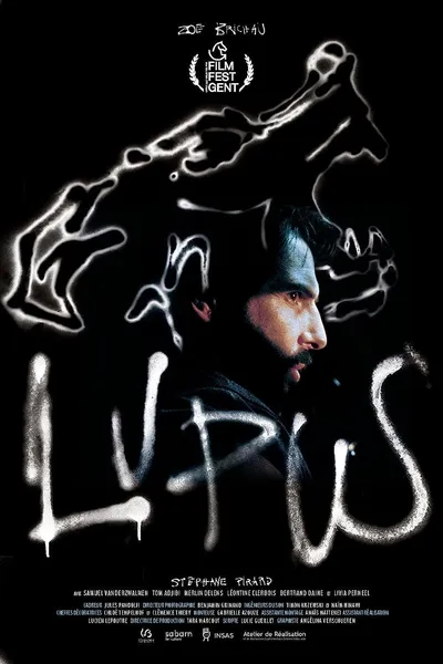 Lupus