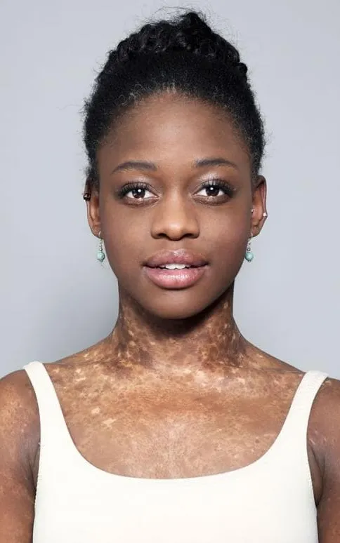 Michaela Deprince